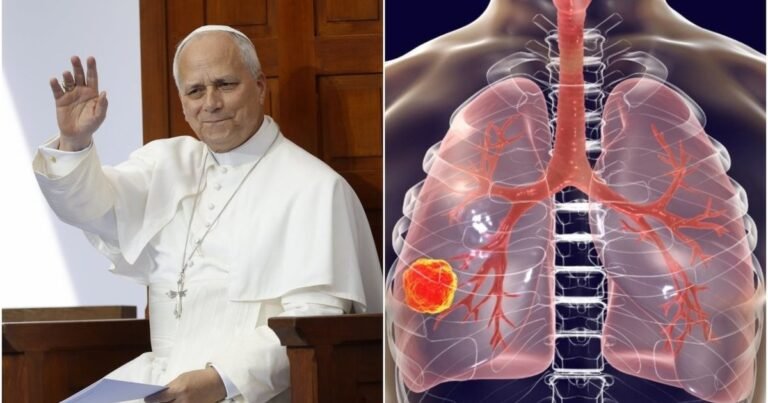 Plaučių vėžys gali prasidėti tyliai: medikai perspėja, kad rizikuoja ne vien rūkantieji