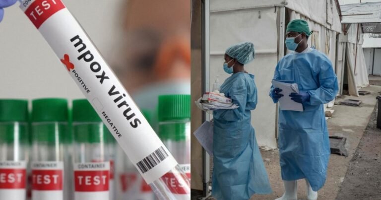 Maskvos srityje sujudo medikai: ligoninėje atsidūrė penki su įtariamuoju kontaktavę žmonės
